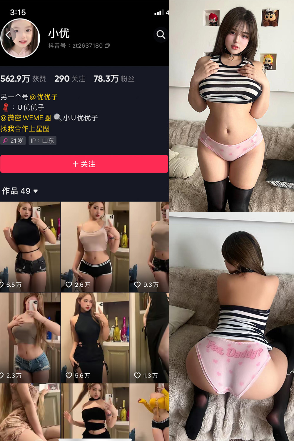 小U优优子微密圈VIP第061期写真：20张美图+1视频